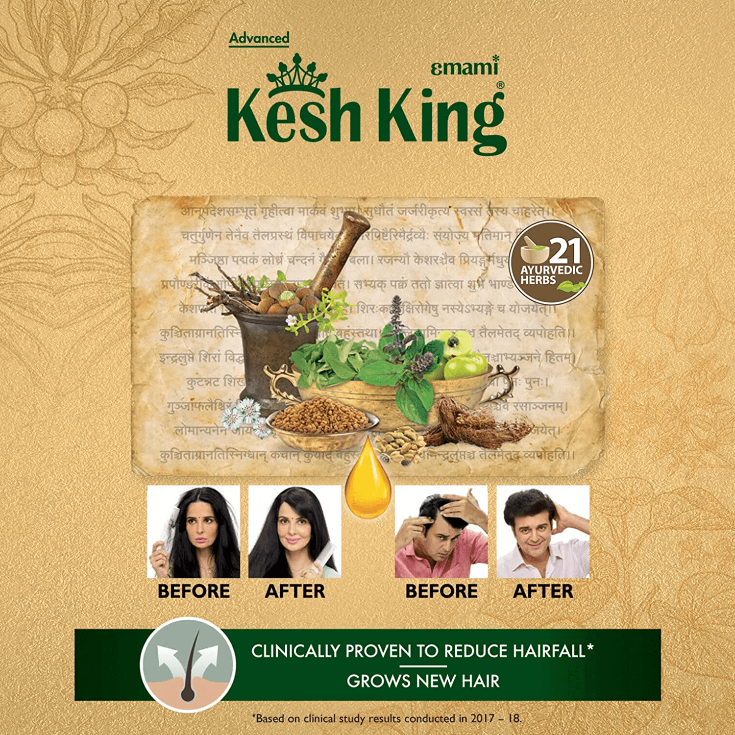 Best Ayurvedic Hair Fall Control Products | Kesh King